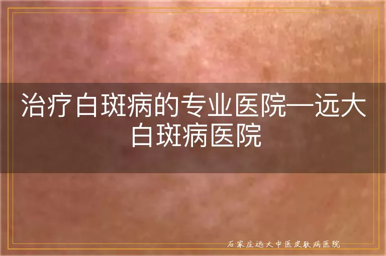 治疗白斑病的专业医院—远大白斑病医院