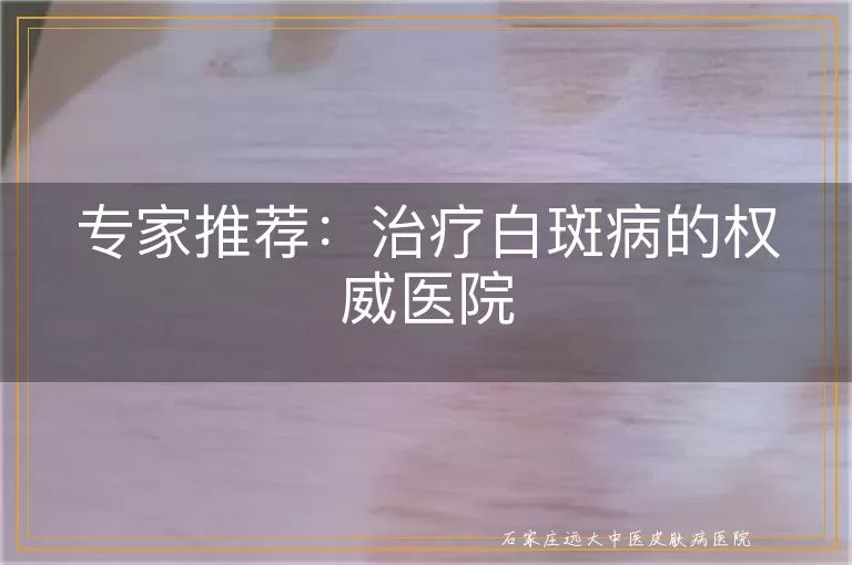 专家推荐：治疗白斑病的权威医院