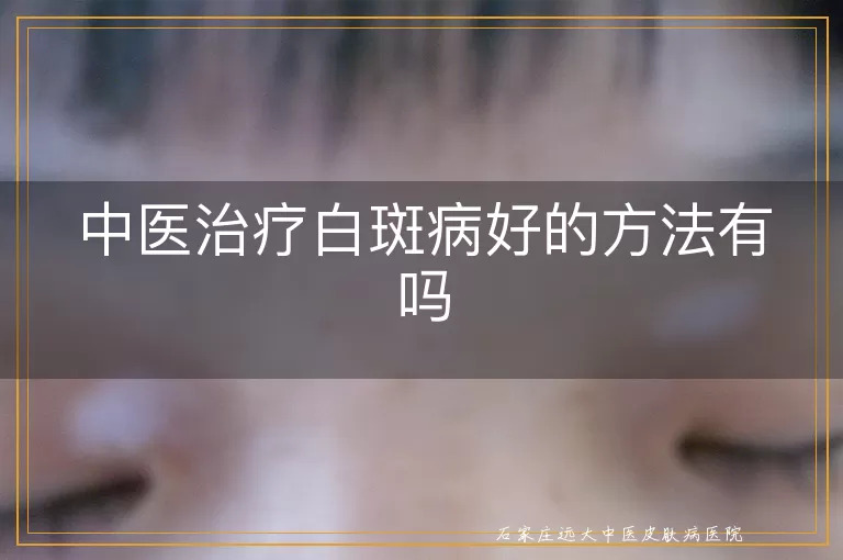 中医治疗白斑病好的方法有吗