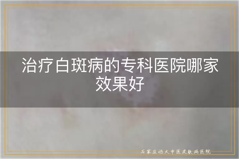 治疗白斑病的专科医院哪家效果好