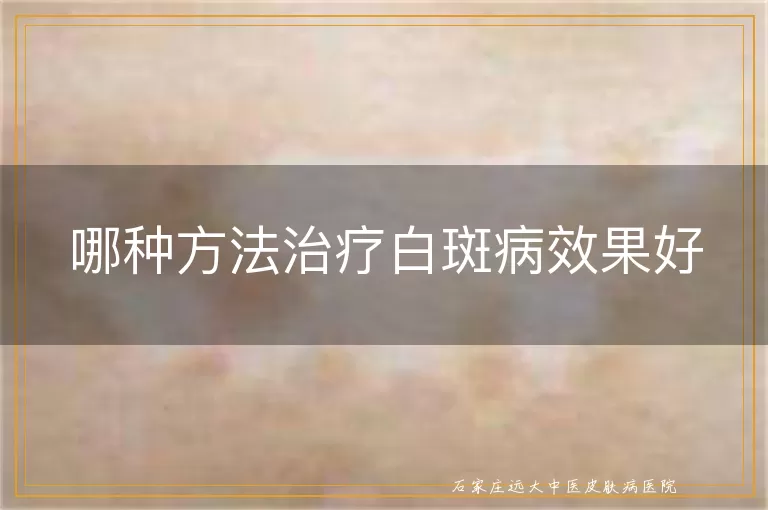 哪种方法治疗白斑病效果好