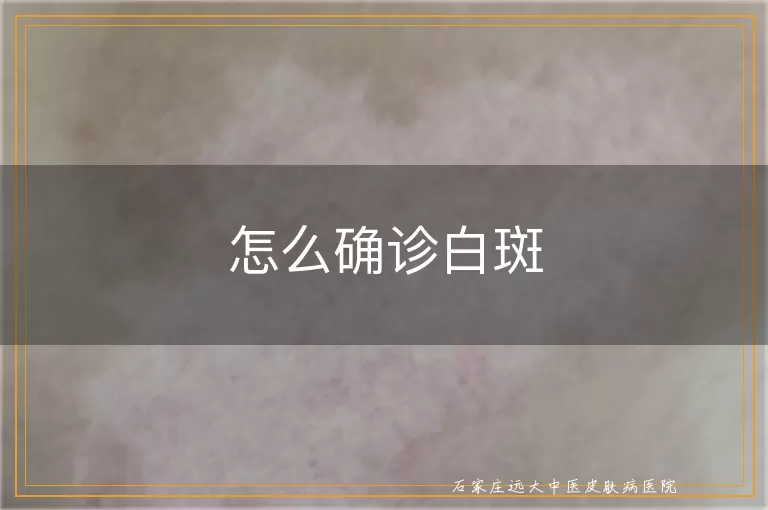 怎么确诊白斑