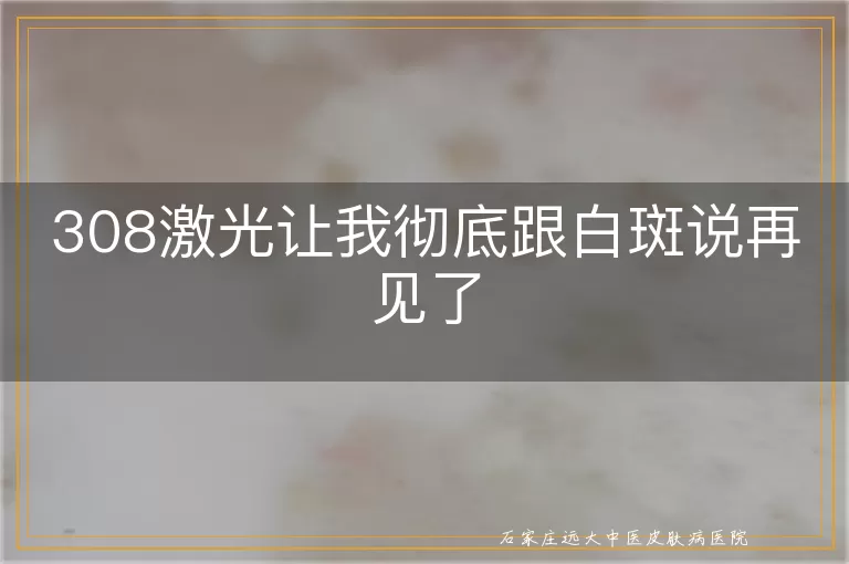308激光让我彻底跟白斑说再见了