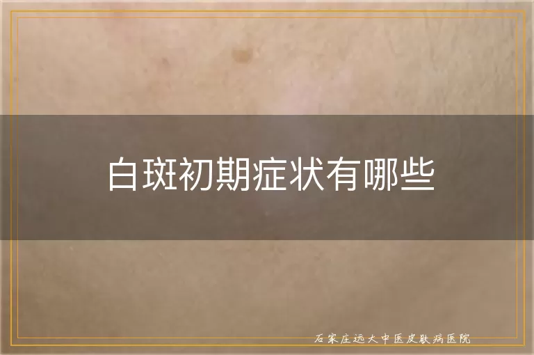 白斑初期症状有哪些