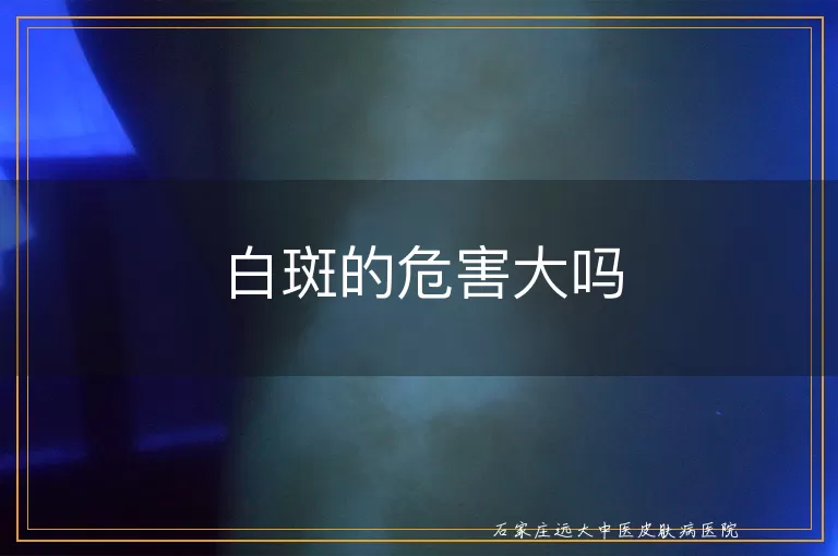 白斑的危害大吗
