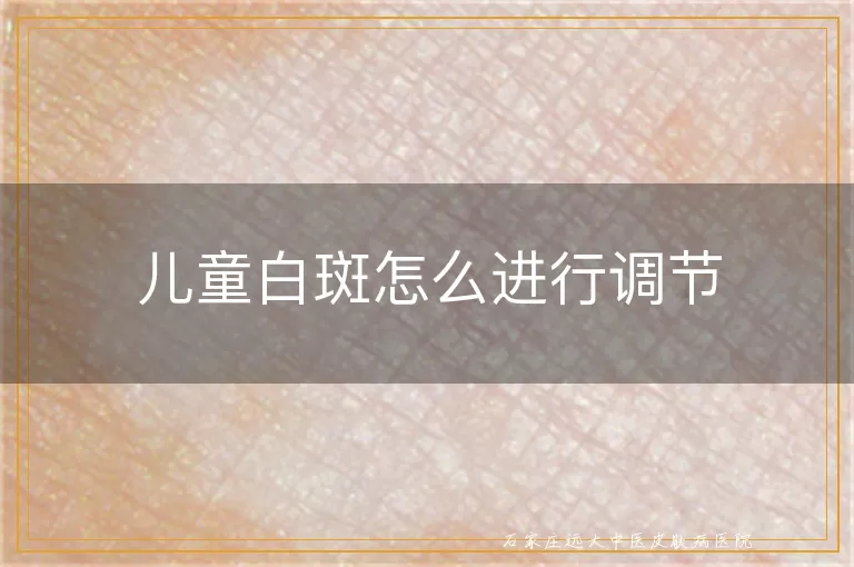 儿童白斑怎么进行调节