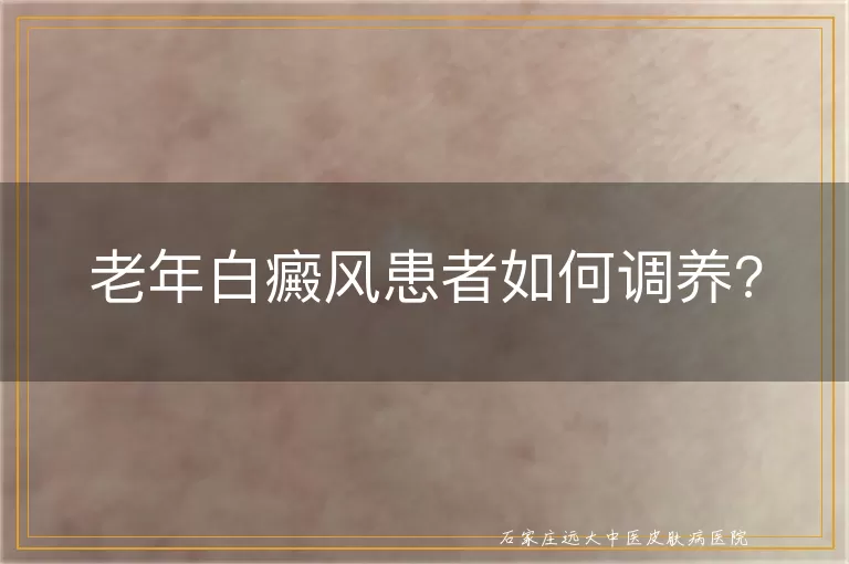 老年白癜风患者如何调养?