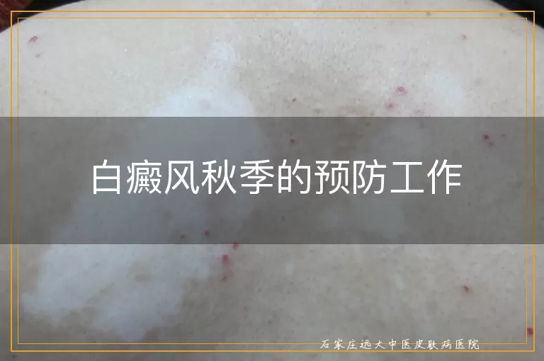白癜风秋季的预防工作