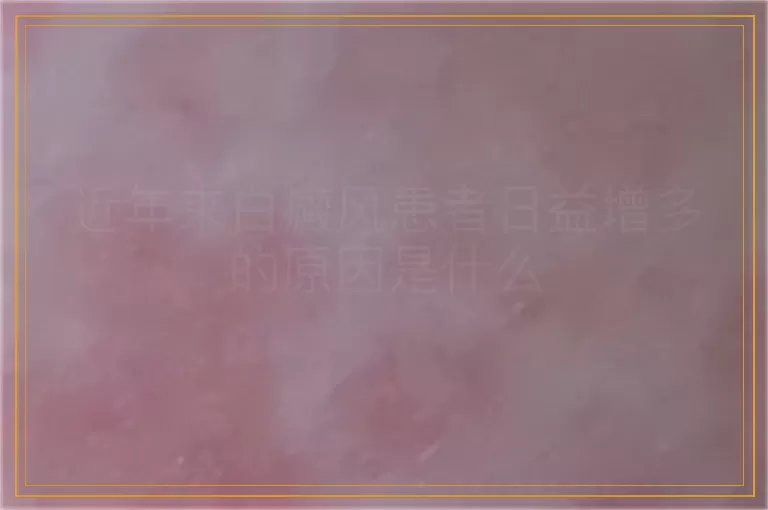近年来白癜风患者日益增多的原因是什么