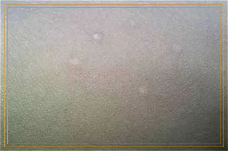 胳膊和腿上都长了小白点是白癜风吗