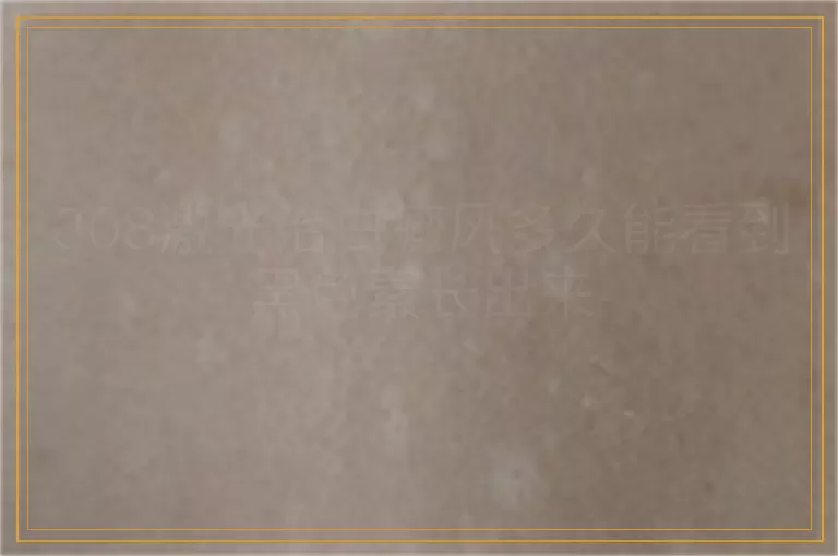 308激光治白癜风多久能看到黑色素长出来