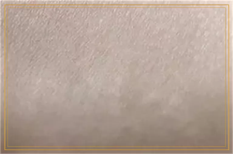 白癜风初期用什么药效果好