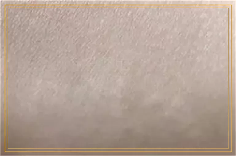 伍德灯检查的白斑没反应还是白癜风吗