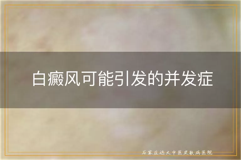 白癜风可能引发的并发症