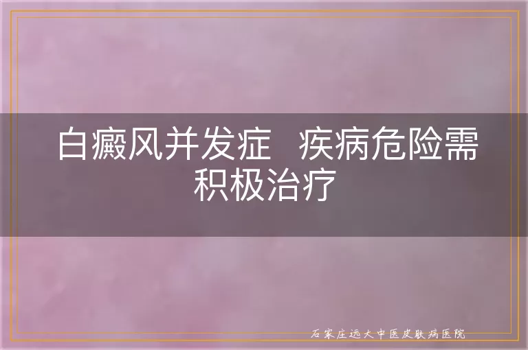 白癜风并发症  疾病危险需积极治疗