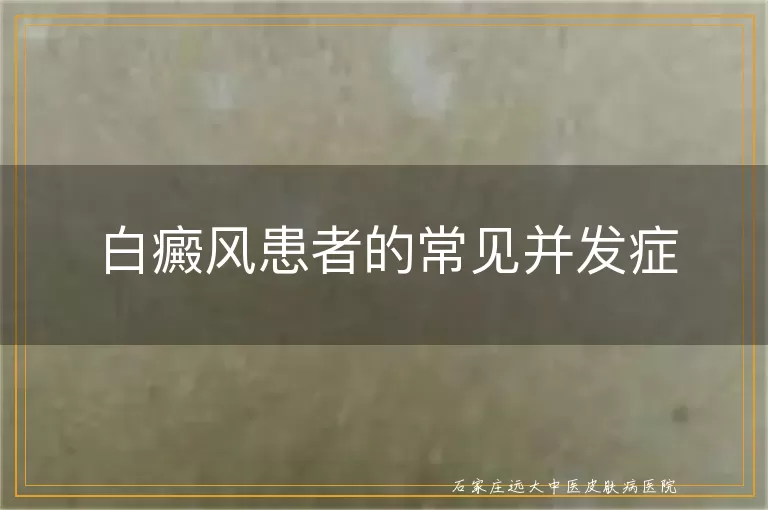 白癜风患者的常见并发症