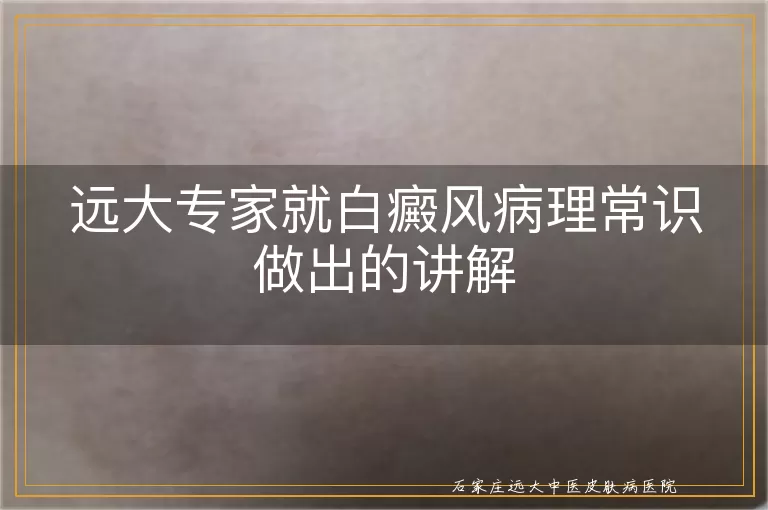 远大专家就白癜风病理常识做出的讲解