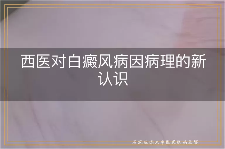 西医对白癜风病因病理的新认识