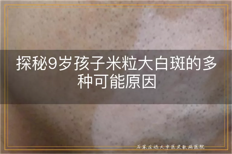 探秘9岁孩子米粒大白斑的多种可能原因
