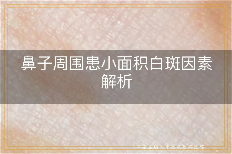 鼻子周围患小面积白斑因素解析