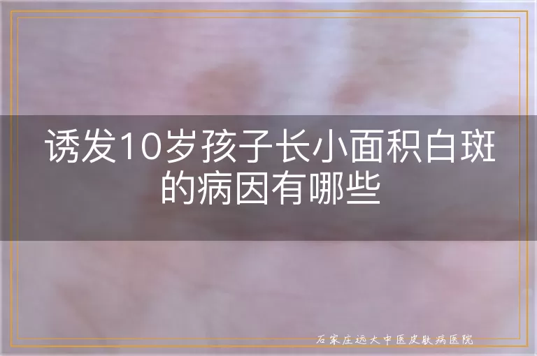 诱发10岁孩子长小面积白斑的病因有哪些