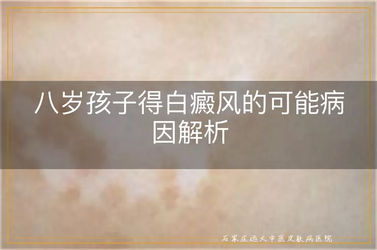 八岁孩子得白癜风的可能病因解析