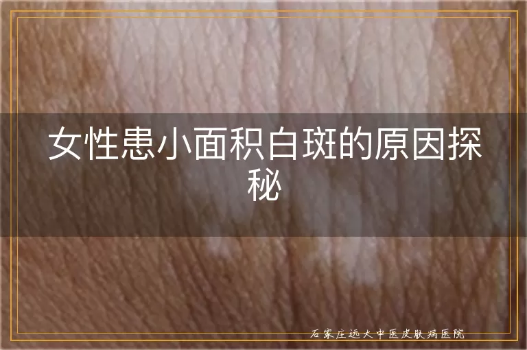 女性患小面积白斑的原因探秘