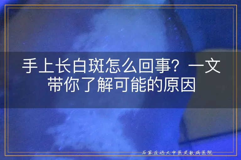 手上长白斑怎么回事？一文带你了解可能的原因
