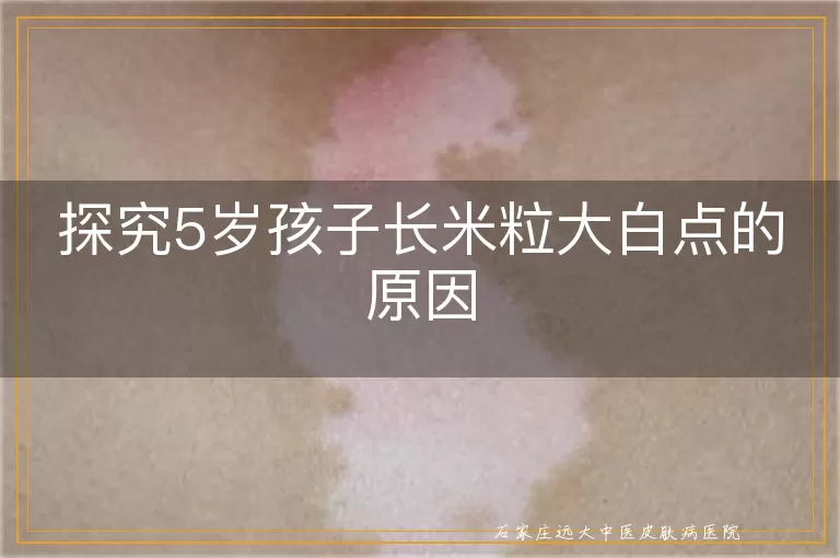 探究5岁孩子长米粒大白点的原因