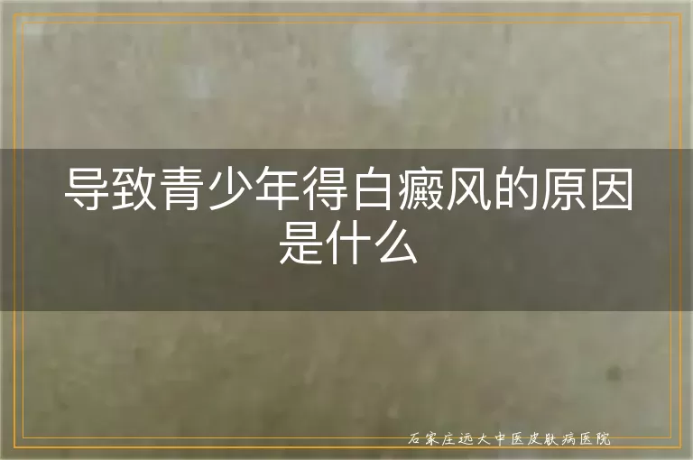 导致青少年得白癜风的原因是什么