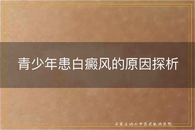 青少年患白癜风的原因探析