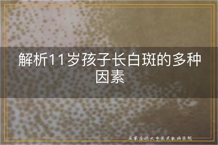 解析11岁孩子长白斑的多种因素
