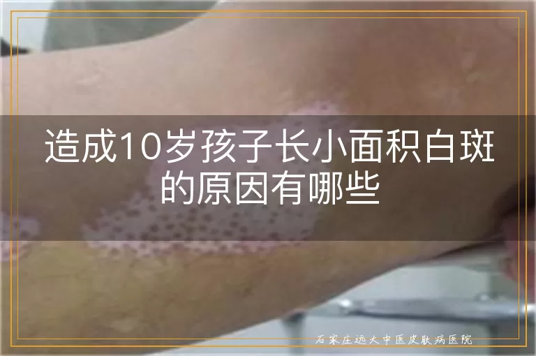 造成10岁孩子长小面积白斑的原因有哪些