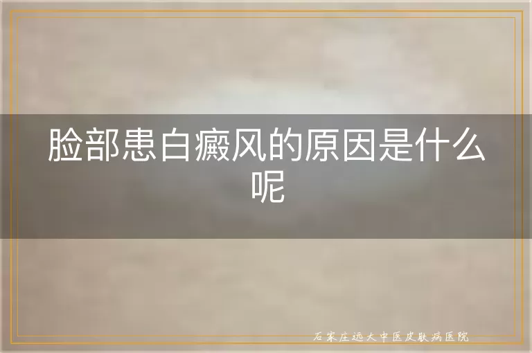 脸部患白癜风的原因是什么呢