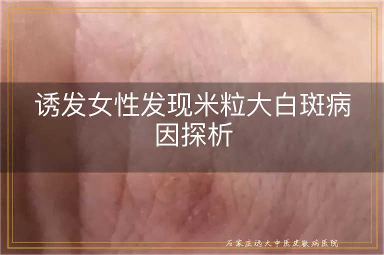 诱发女性发现米粒大白斑病因探析