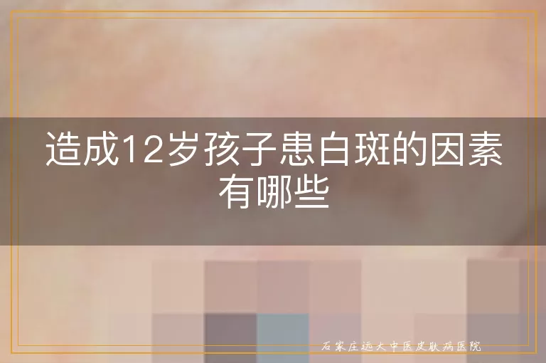 造成12岁孩子患白斑的因素有哪些