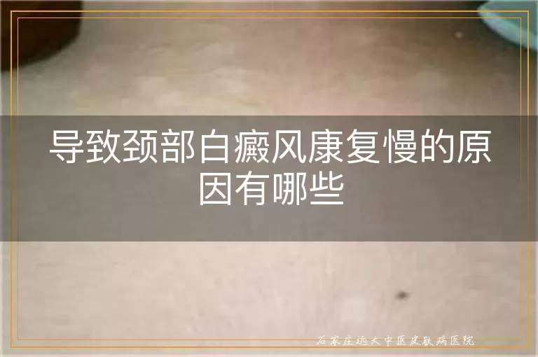 导致颈部白癜风康复慢的原因有哪些