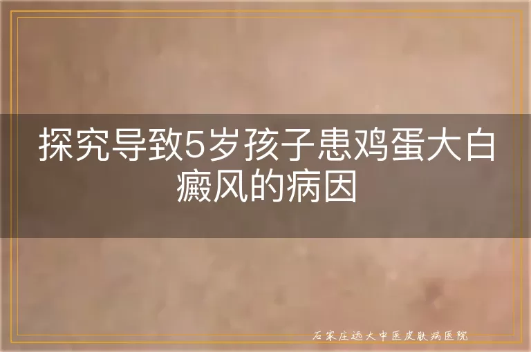 探究导致5岁孩子患鸡蛋大白癜风的病因