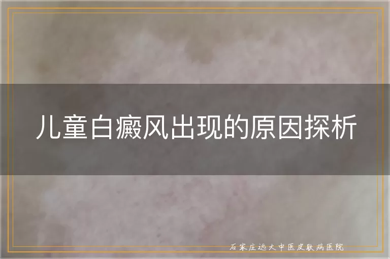 儿童白癜风出现的原因探析