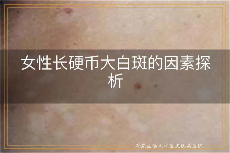 女性长硬币大白斑的因素探析