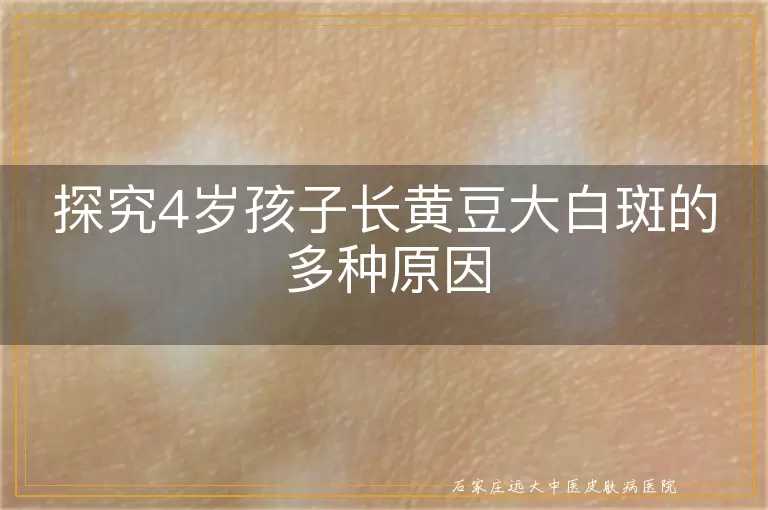 探究4岁孩子长黄豆大白斑的多种原因