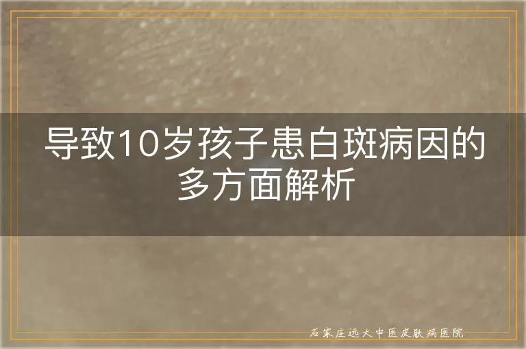 导致10岁孩子患白斑病因的多方面解析