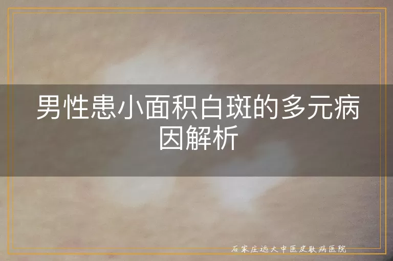 男性患小面积白斑的多元病因解析