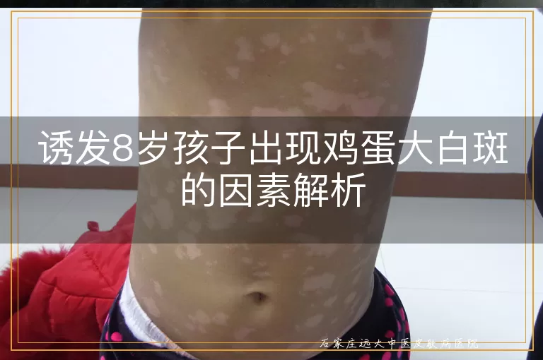 诱发8岁孩子出现鸡蛋大白斑的因素解析