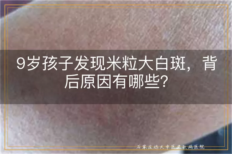 9岁孩子发现米粒大白斑，背后原因有哪些？