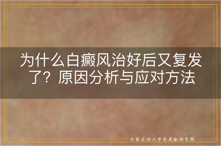 为什么白癜风治好后又复发了？原因分析与应对方法