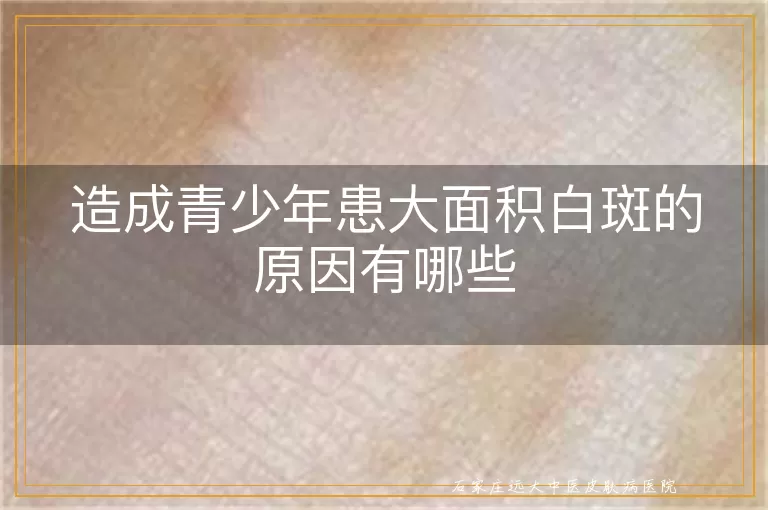 造成青少年患大面积白斑的原因有哪些