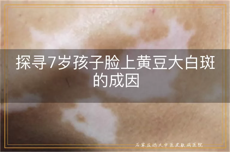 探寻7岁孩子脸上黄豆大白斑的成因