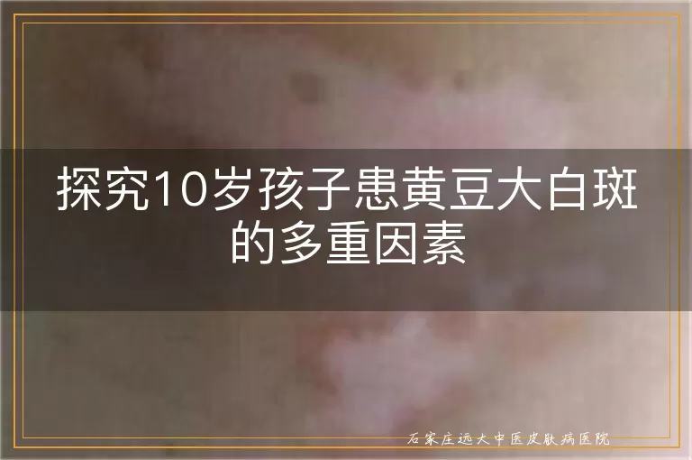 探究10岁孩子患黄豆大白斑的多重因素