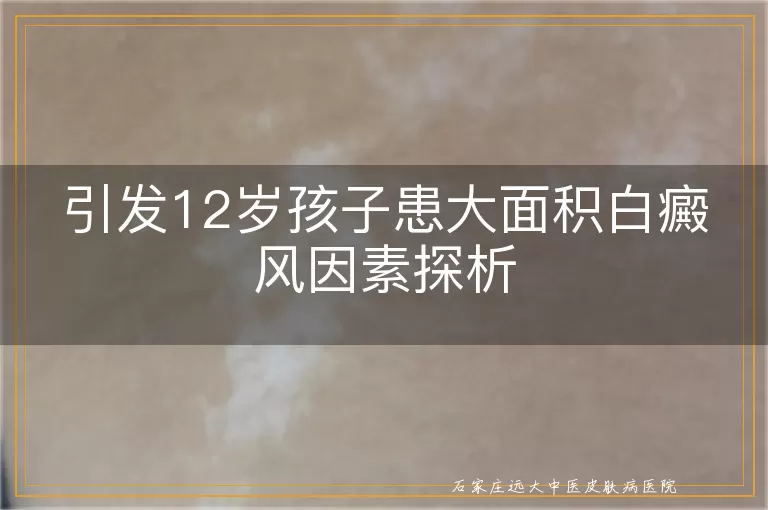 引发12岁孩子患大面积白癜风因素探析
